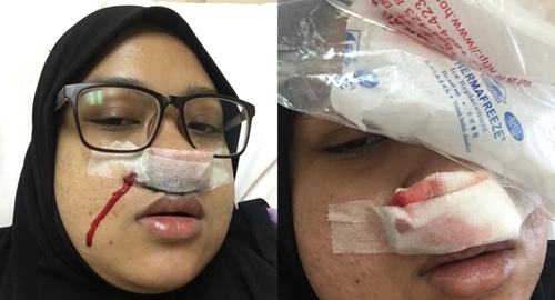 raja penawar resdung